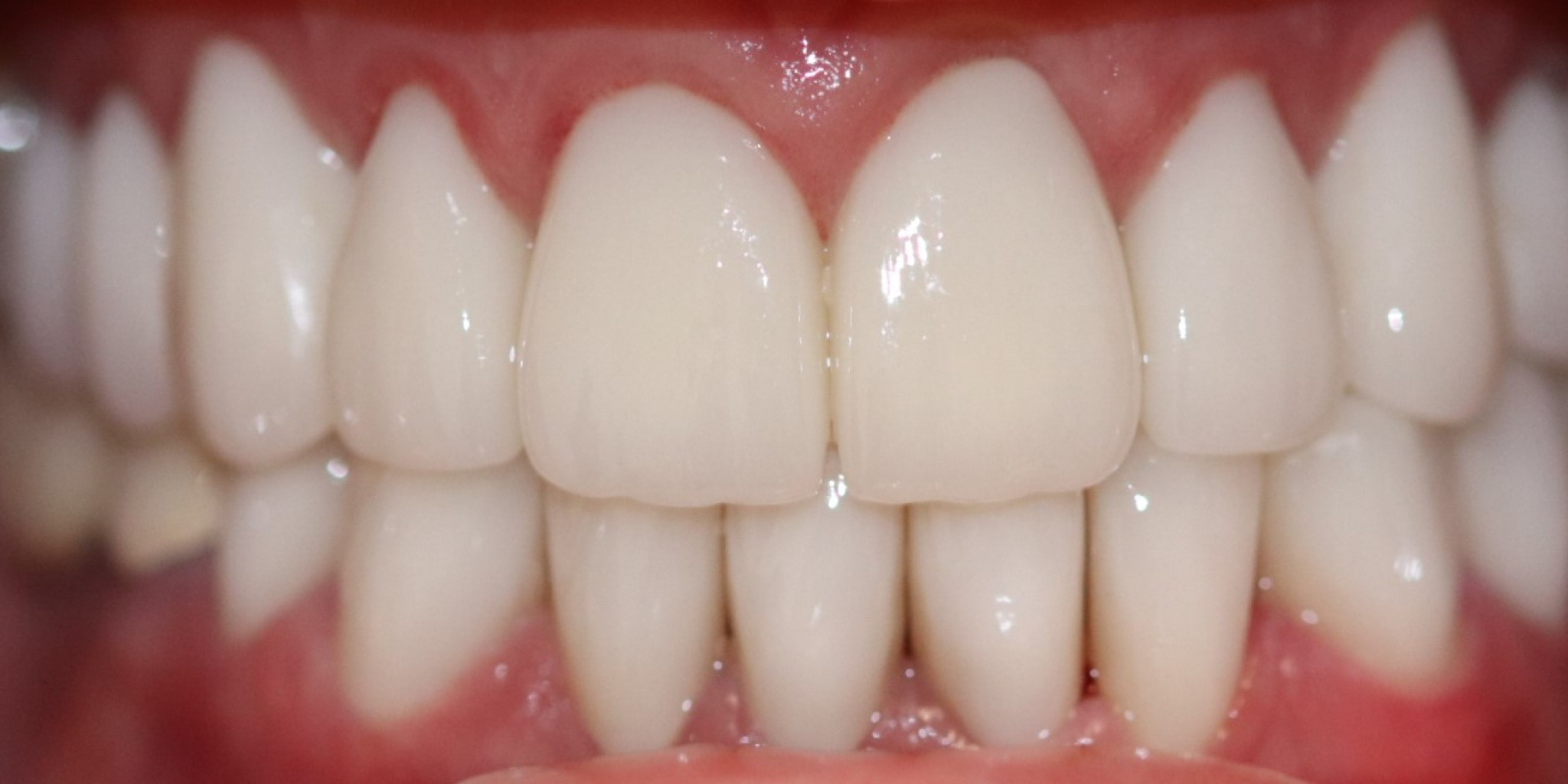 Zdjęcie po metamorfozie