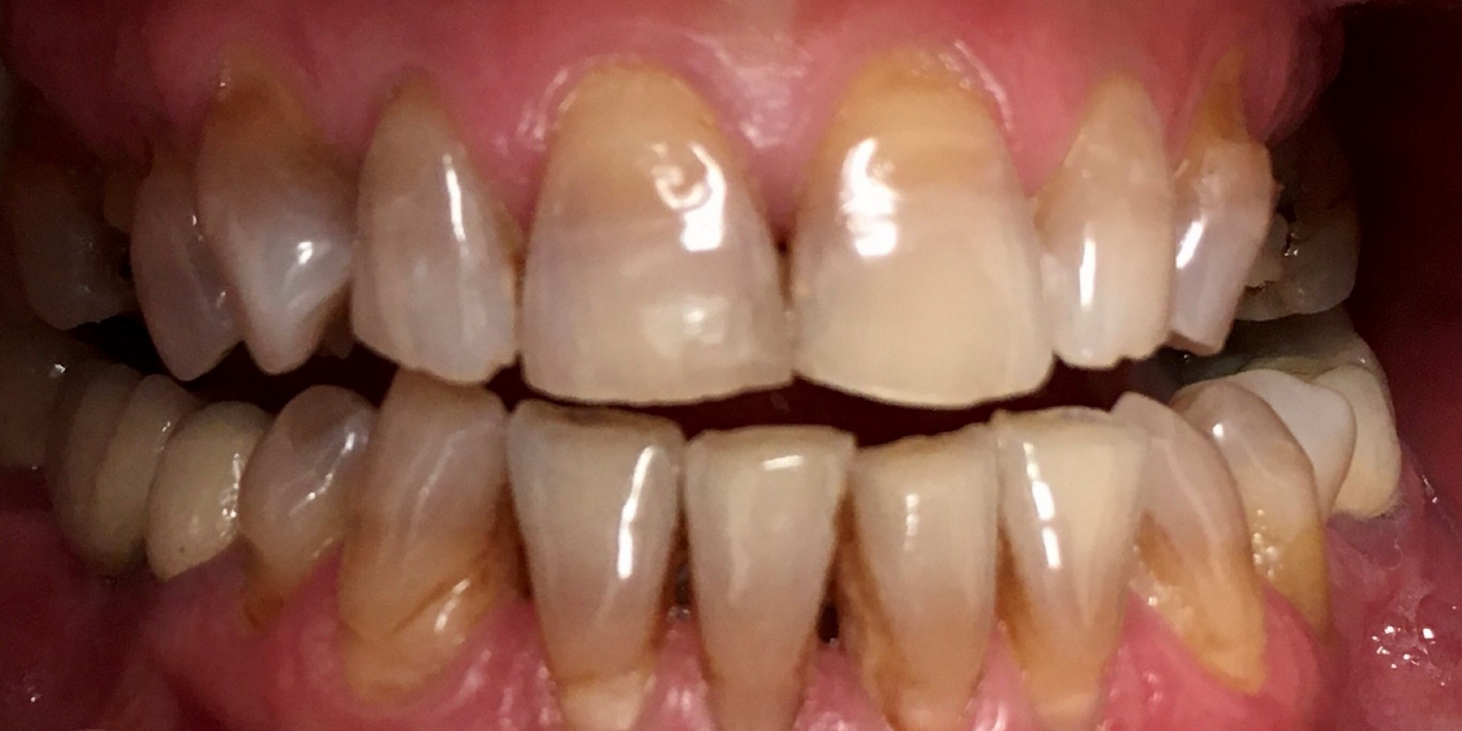 Zdjęcie przed metamorfozą