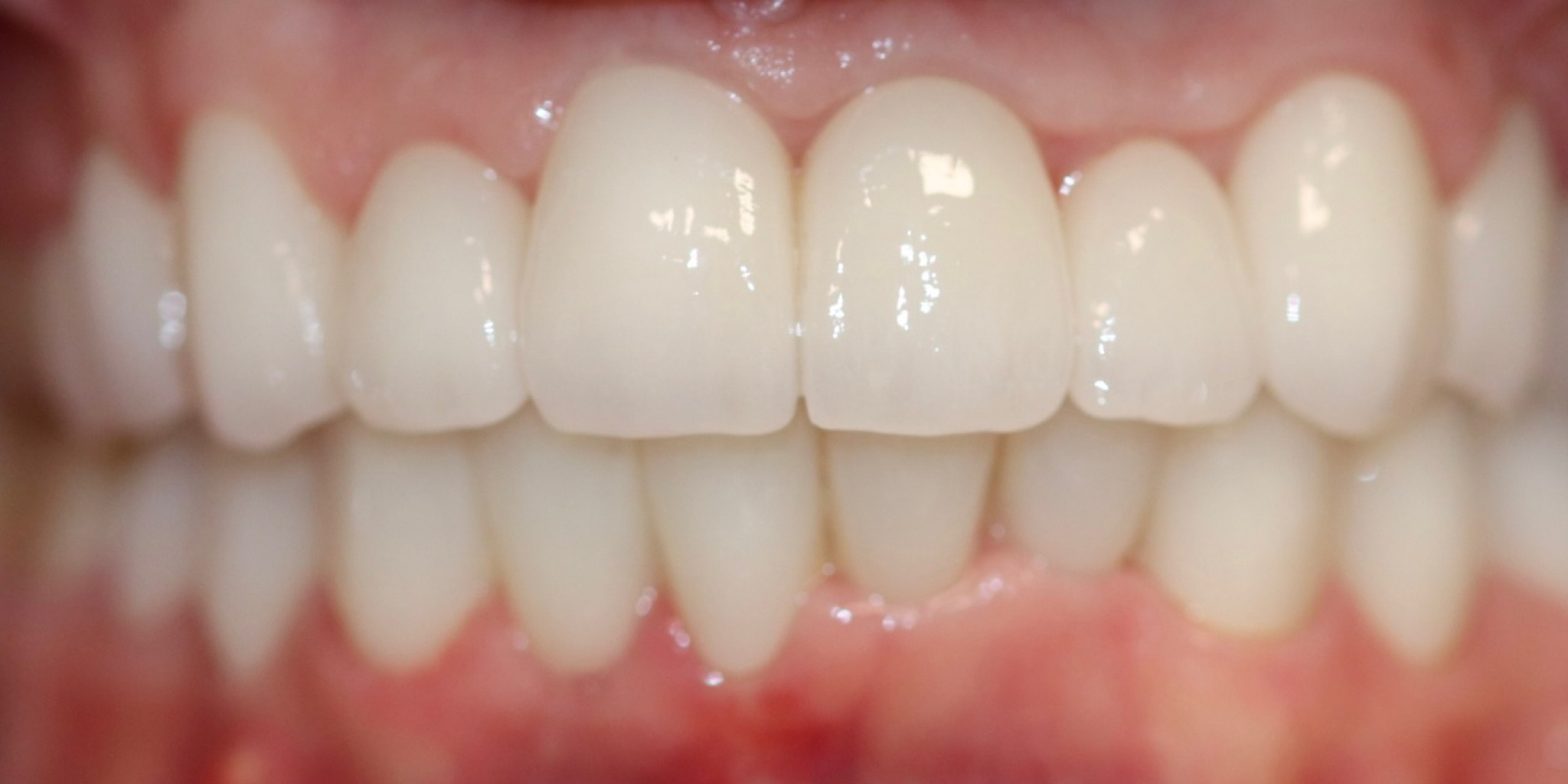 Zdjęcie po metamorfozie