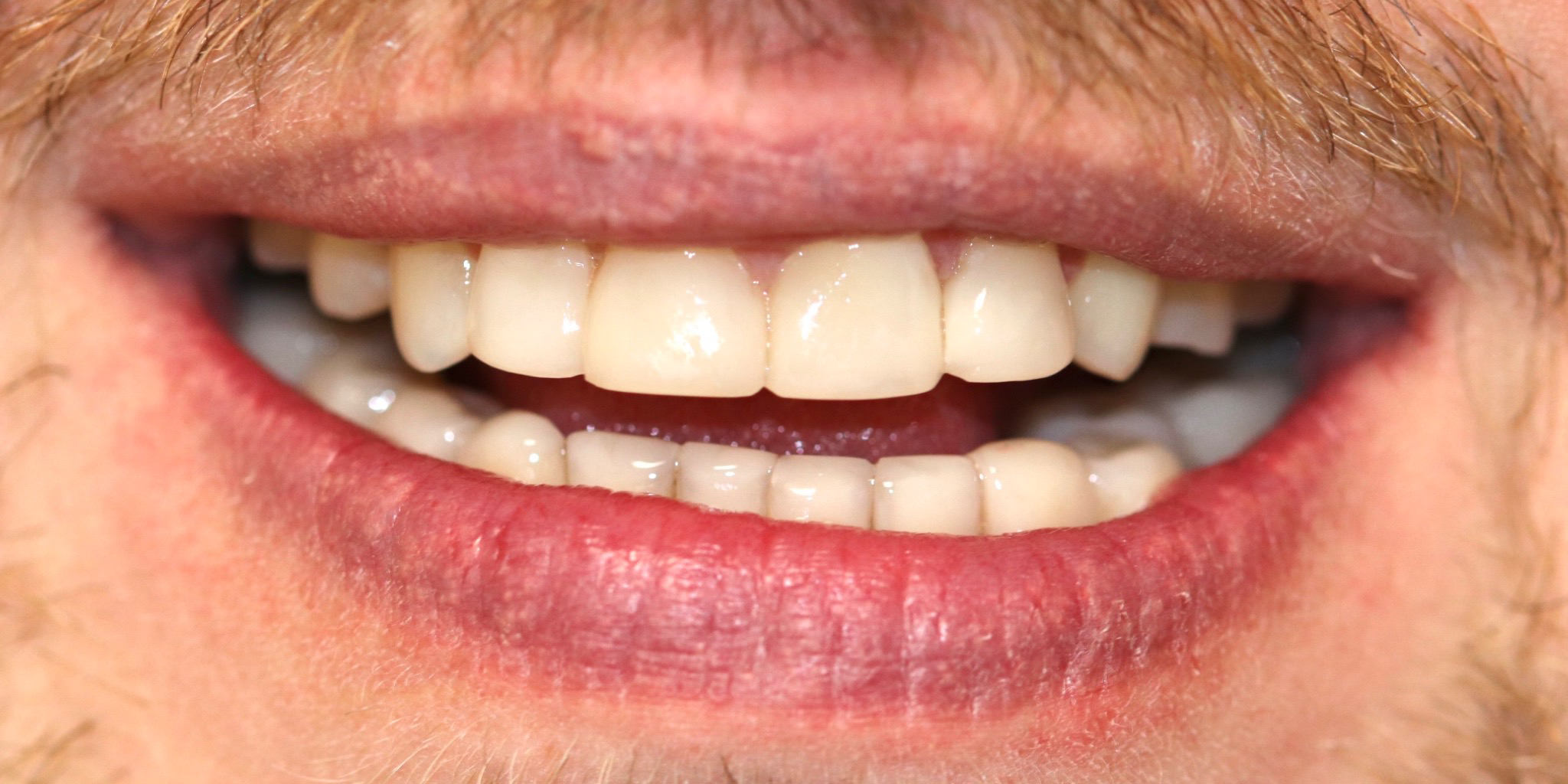 Zdjęcie po metamorfozie