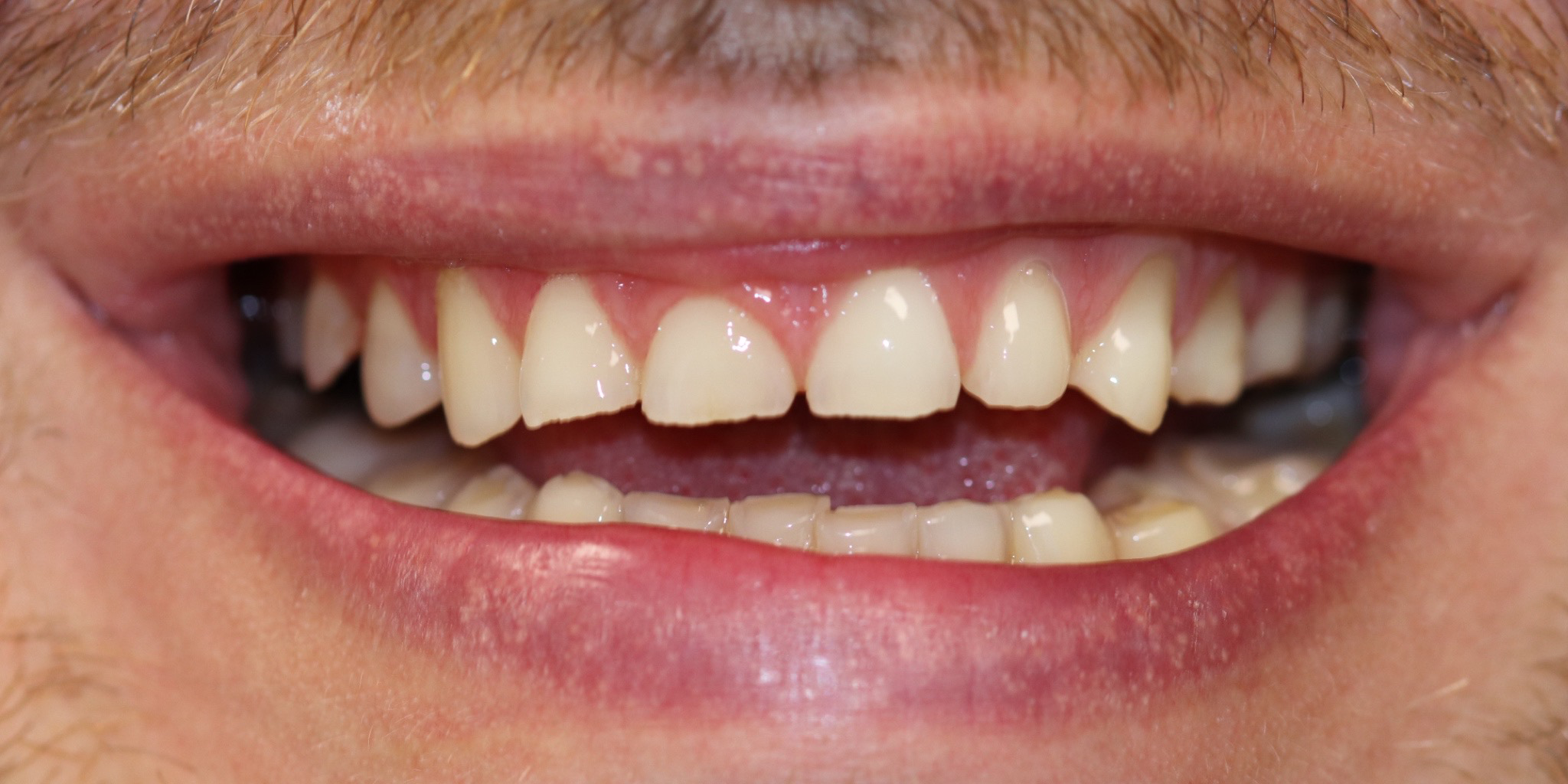 Zdjęcie przed metamorfozą