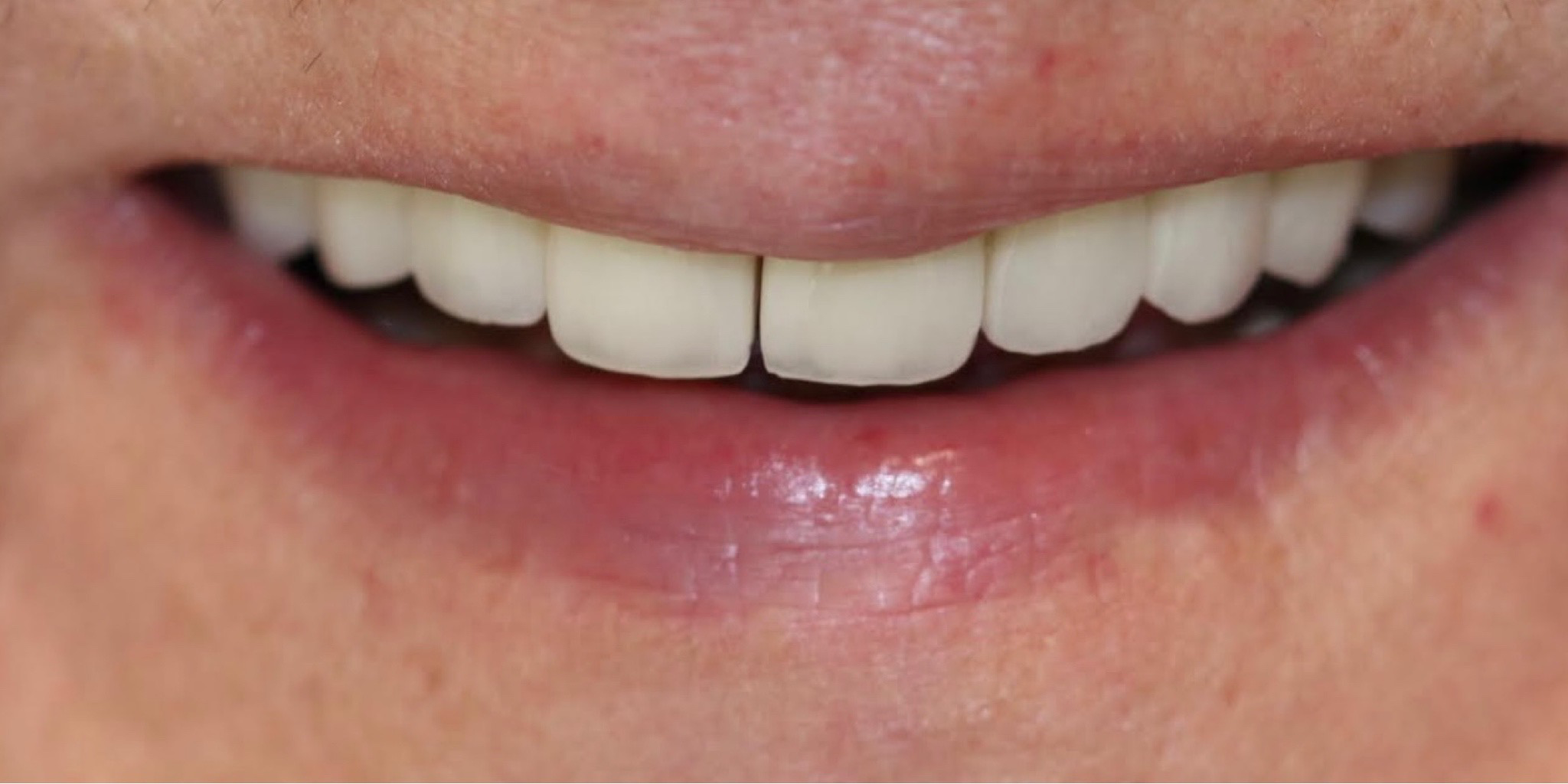 Zdjęcie po metamorfozie