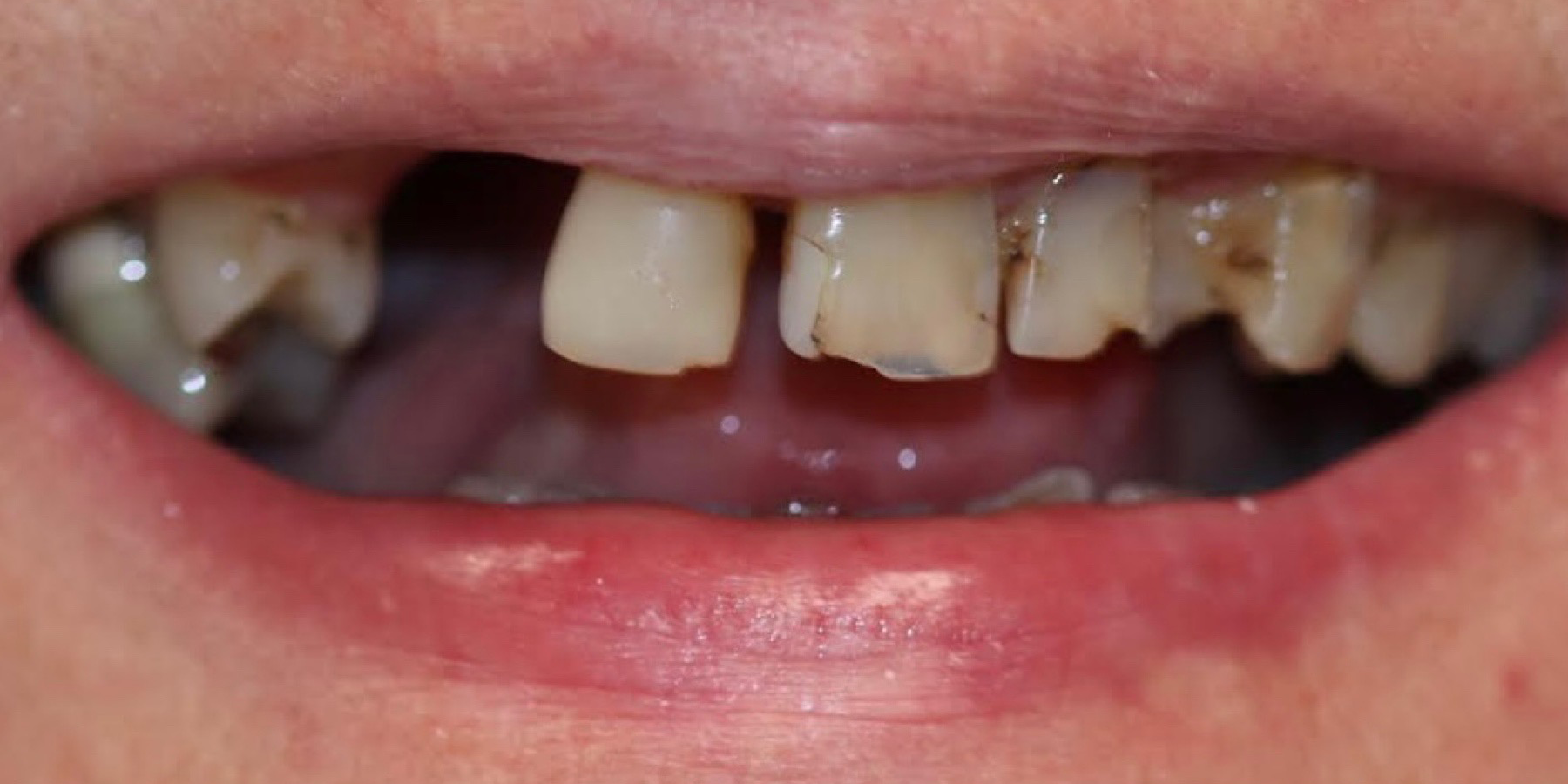 Zdjęcie przed metamorfozą