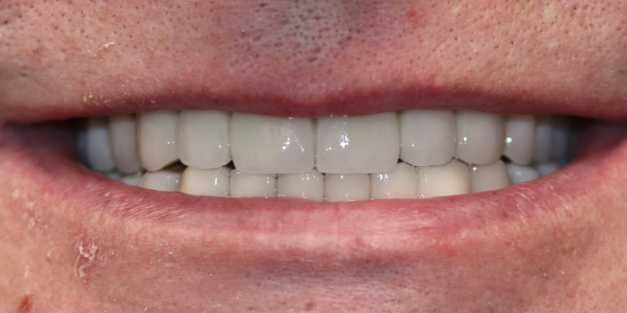 Zdjęcie po metamorfozie