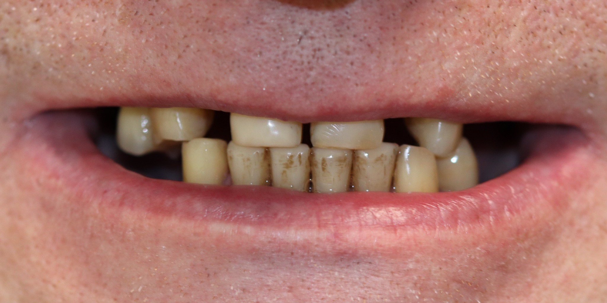 Zdjęcie przed metamorfozą