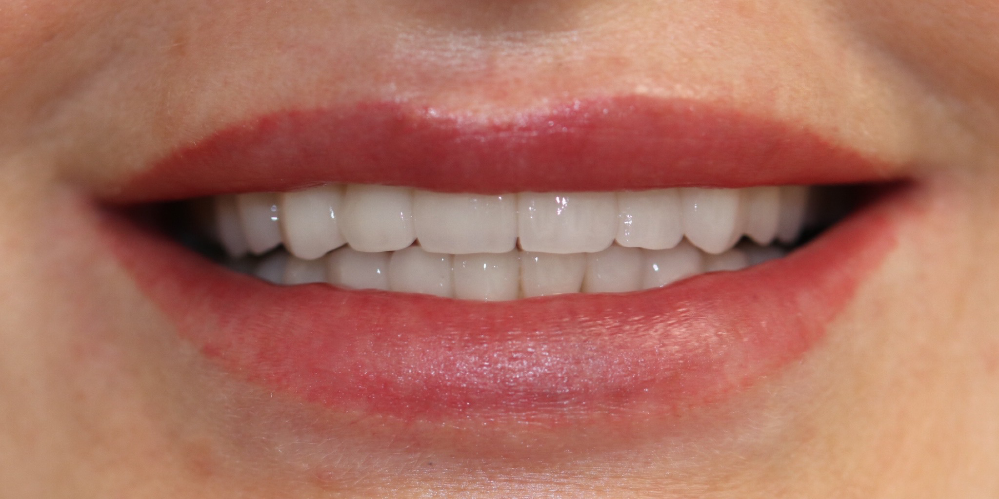 Zdjęcie po metamorfozie