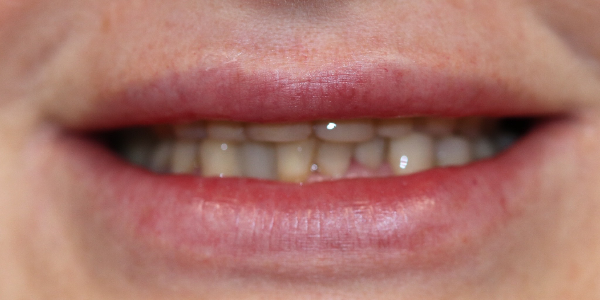 Zdjęcie przed metamorfozą