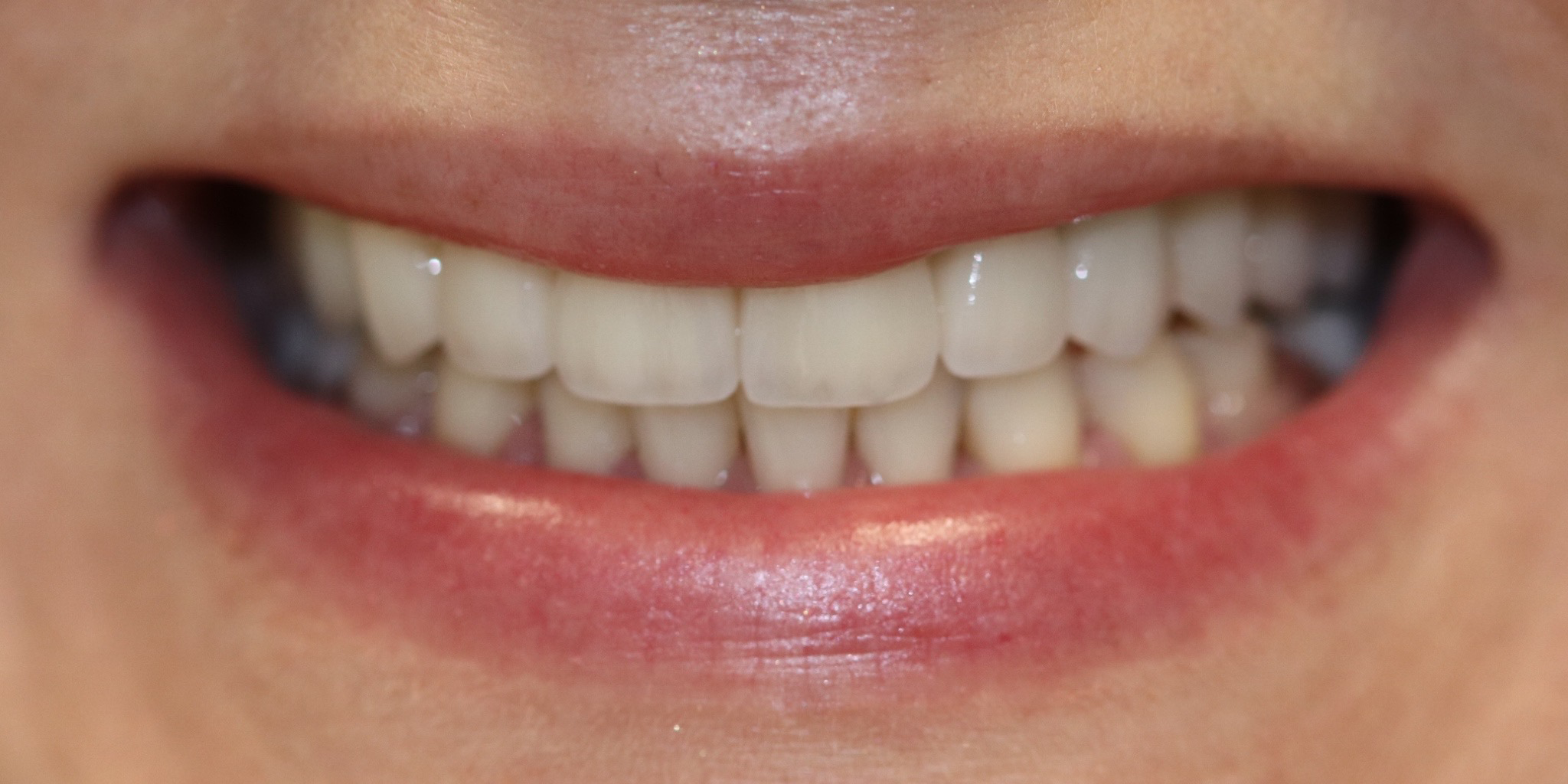 Zdjęcie po metamorfozie