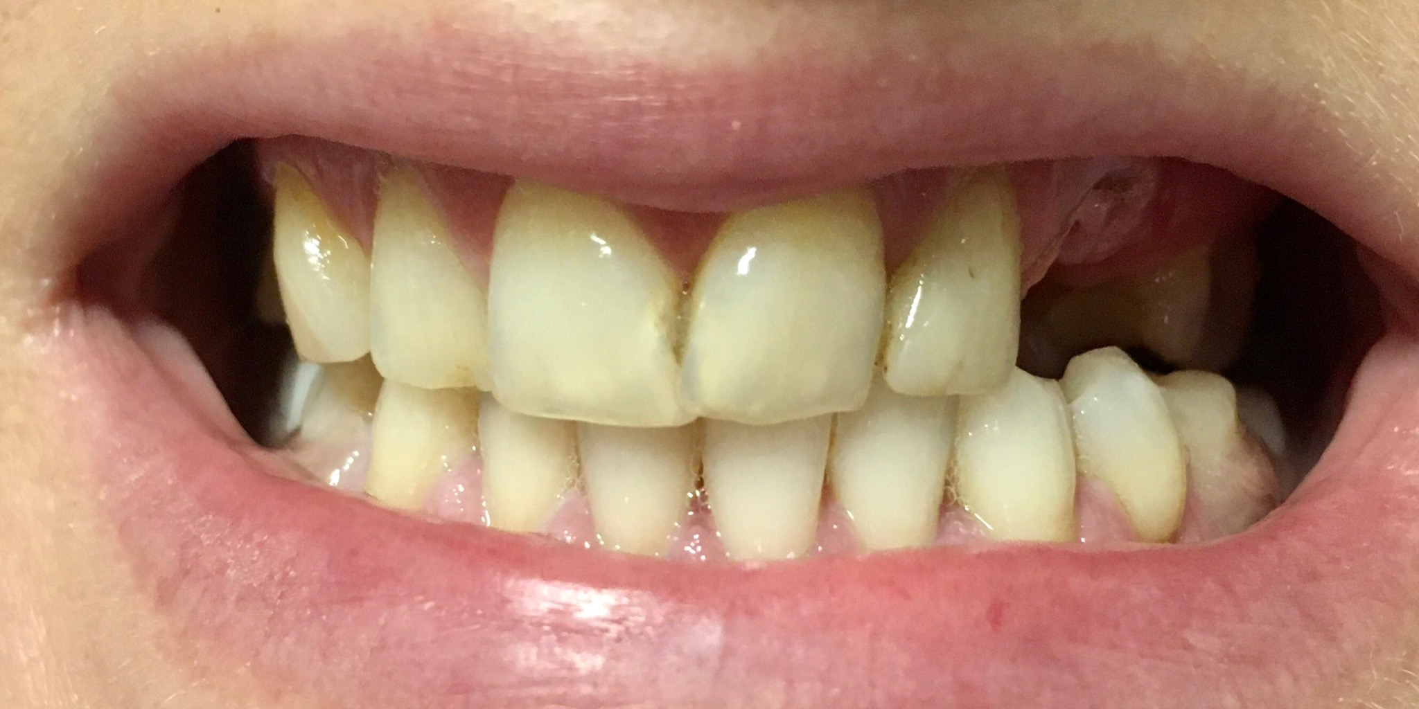 Zdjęcie przed metamorfozą