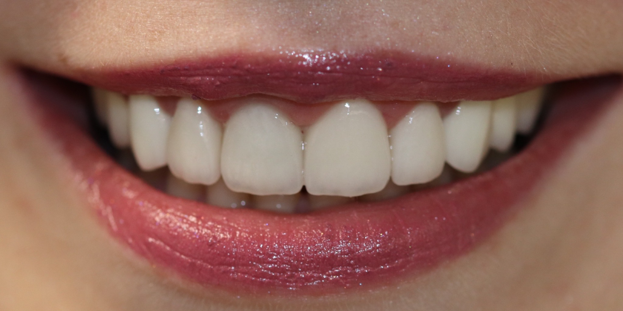 Zdjęcie po metamorfozie