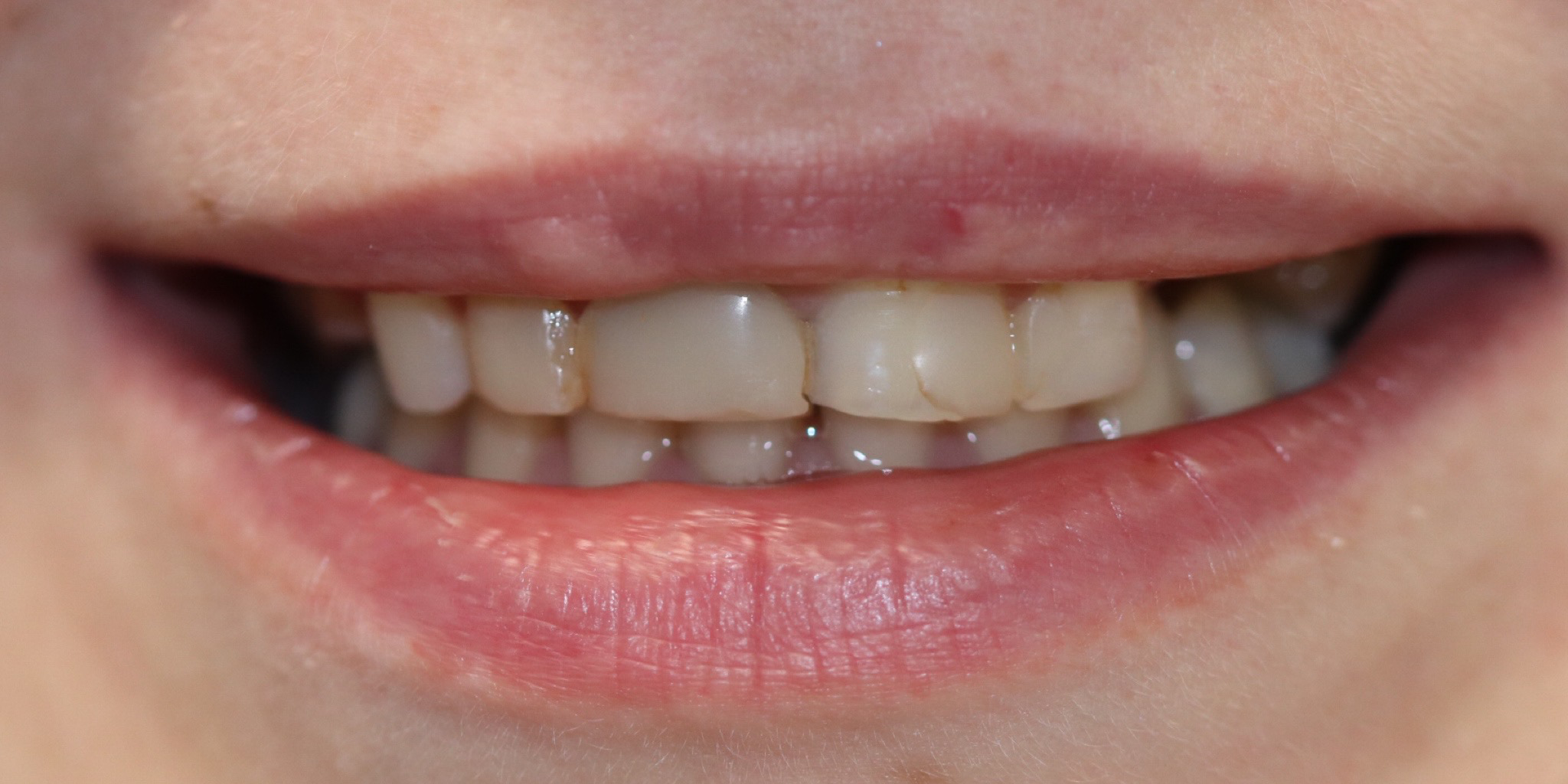 Zdjęcie przed metamorfozą