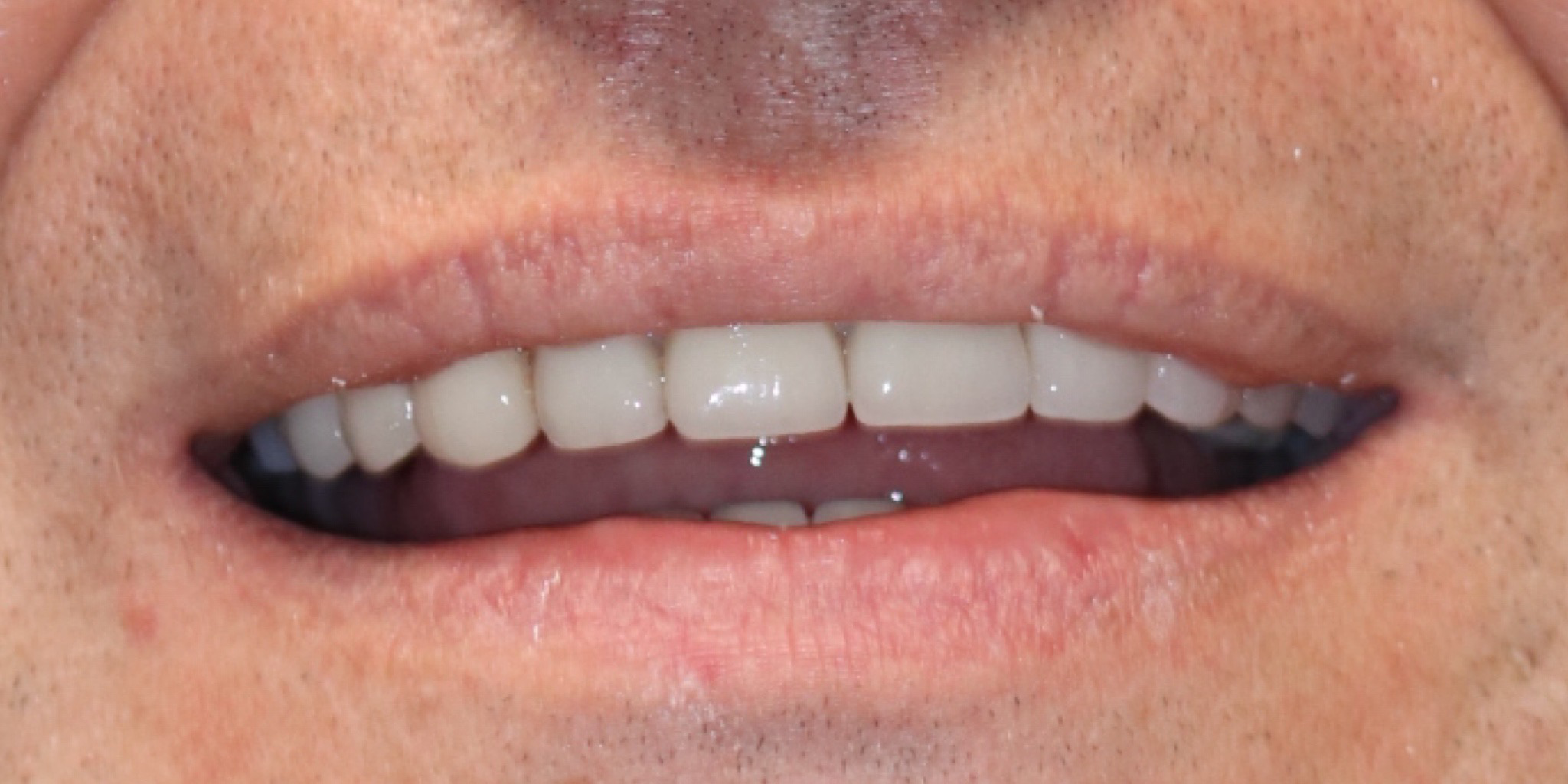 Zdjęcie po metamorfozie