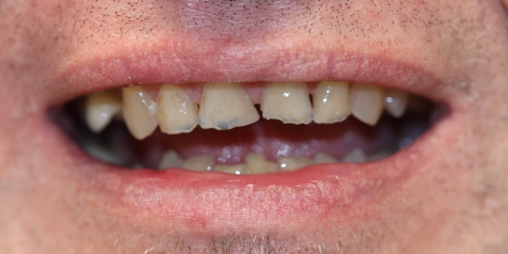 Zdjęcie przed metamorfozą