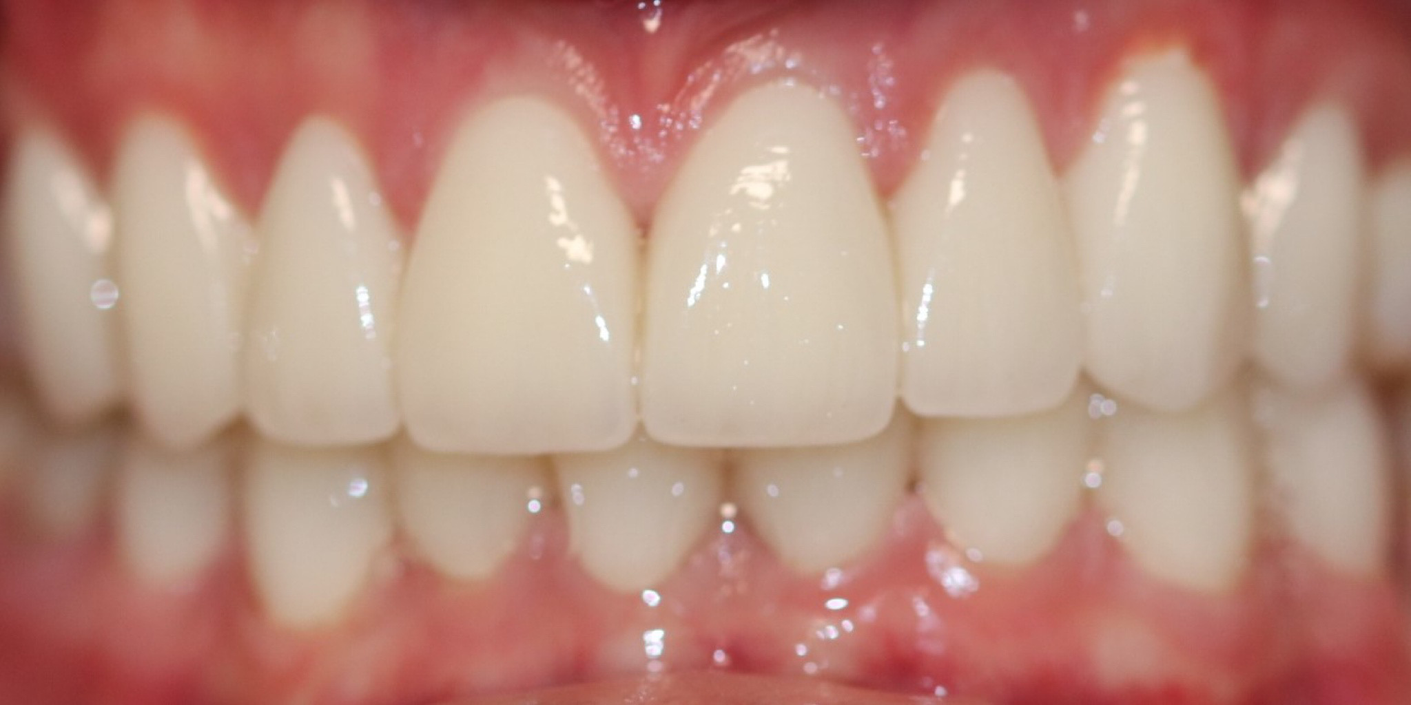 Zdjęcie po metamorfozie