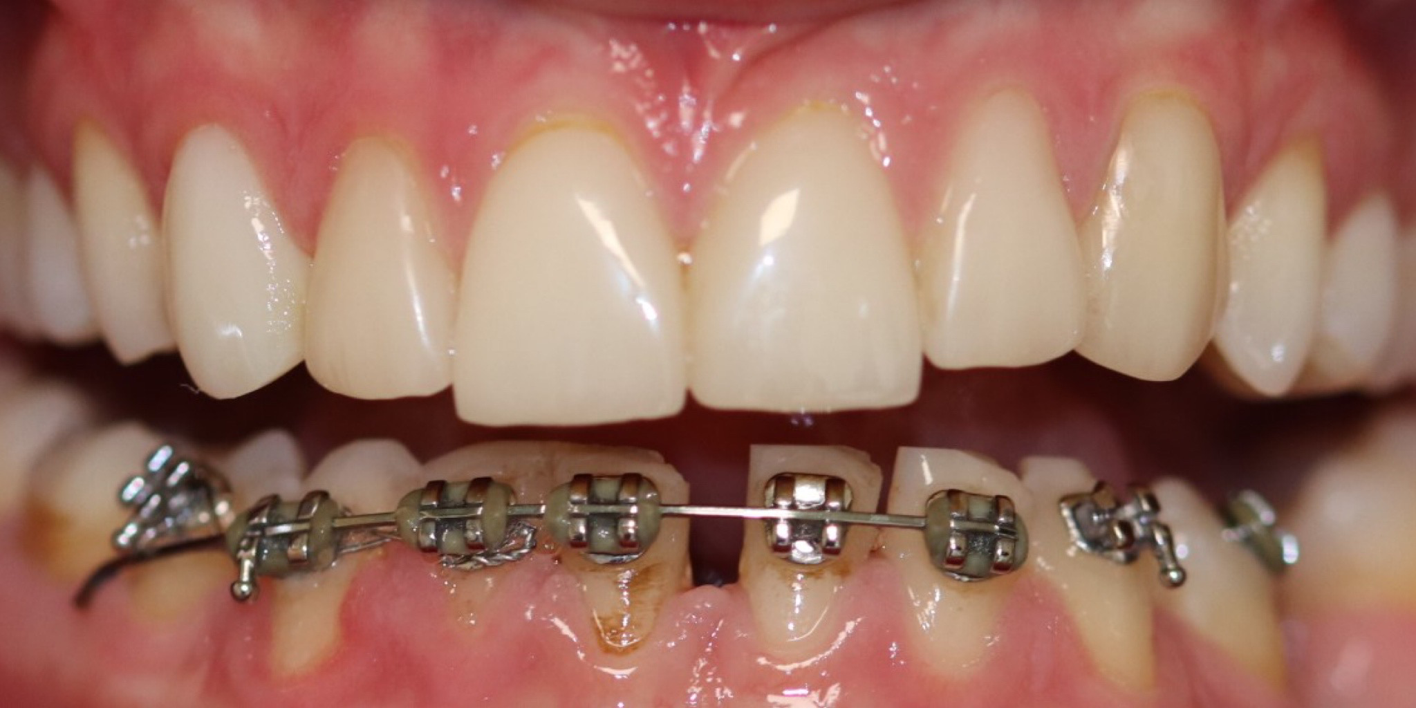 Zdjęcie przed metamorfozą