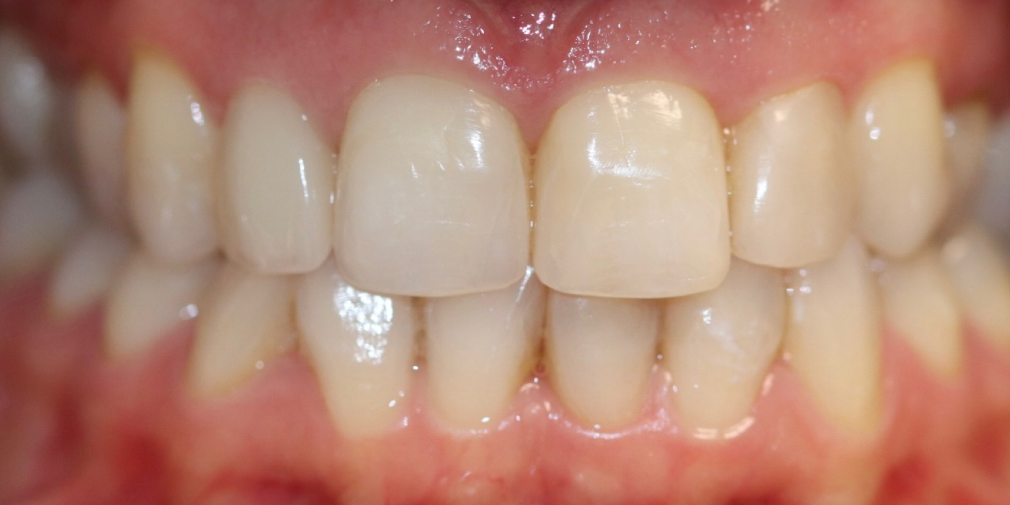 Zdjęcie po metamorfozie