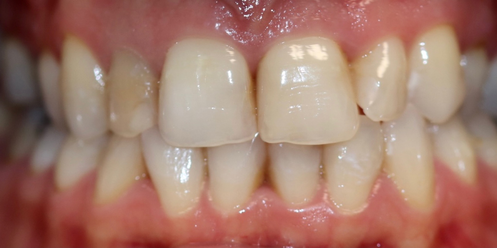 Zdjęcie przed metamorfozą