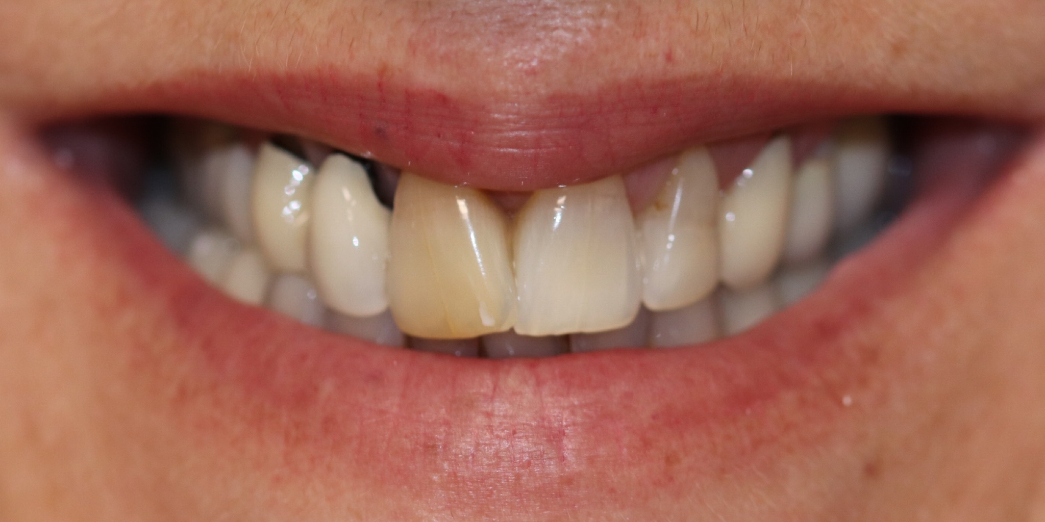 Zdjęcie przed metamorfozą