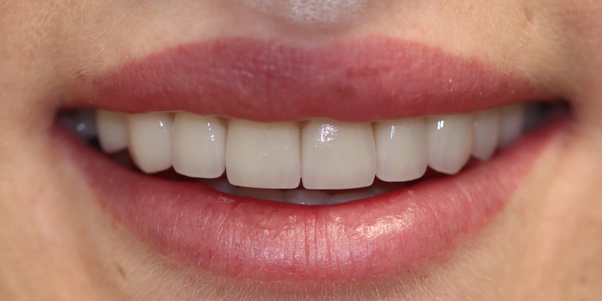 Zdjęcie po metamorfozie