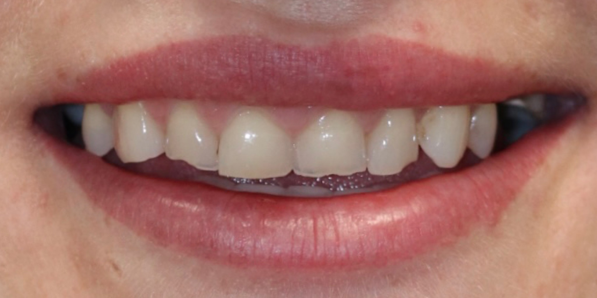 Zdjęcie przed metamorfozą