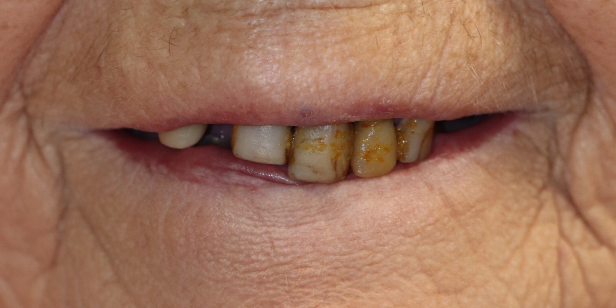 Zdjęcie przed metamorfozą