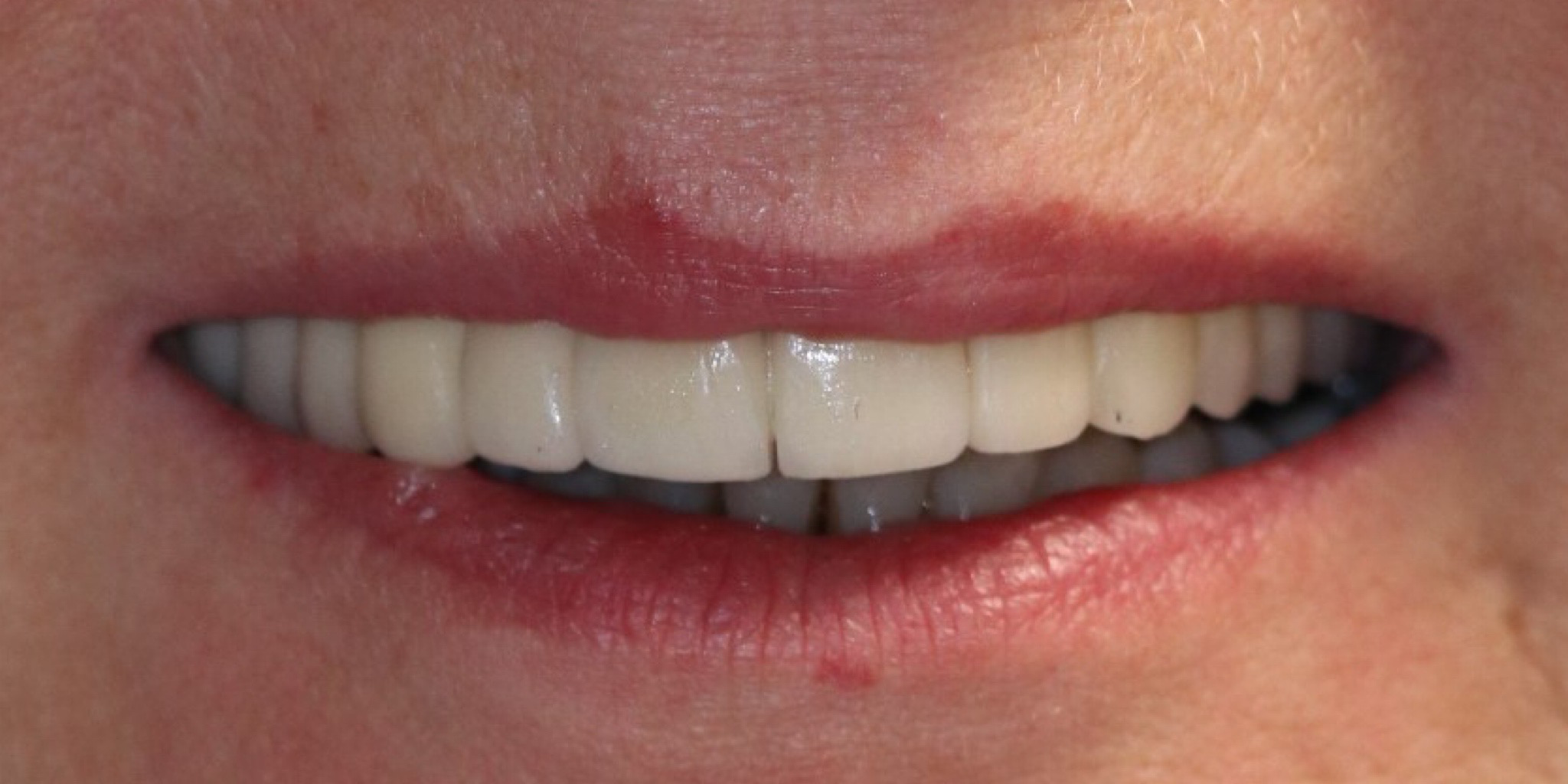 Zdjęcie po metamorfozie