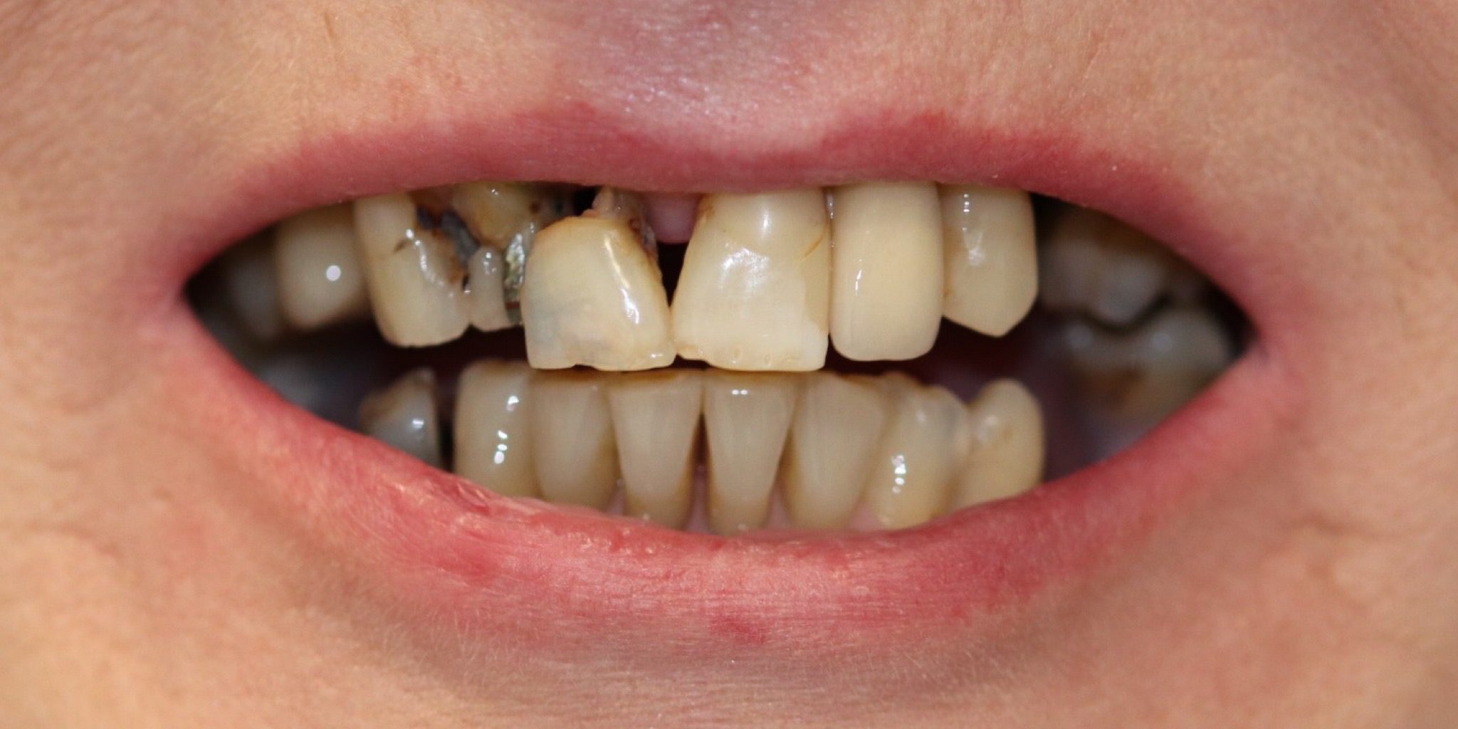 Zdjęcie przed metamorfozą