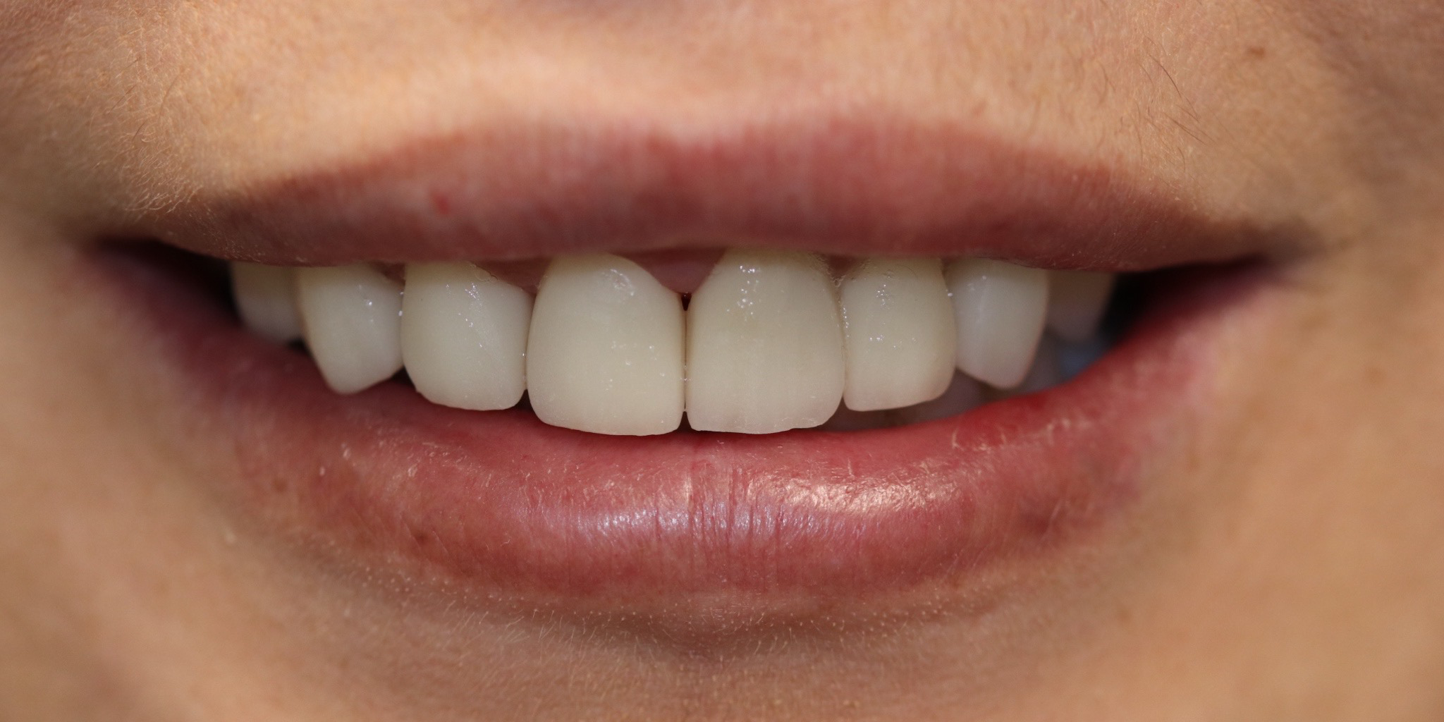 Zdjęcie po metamorfozie