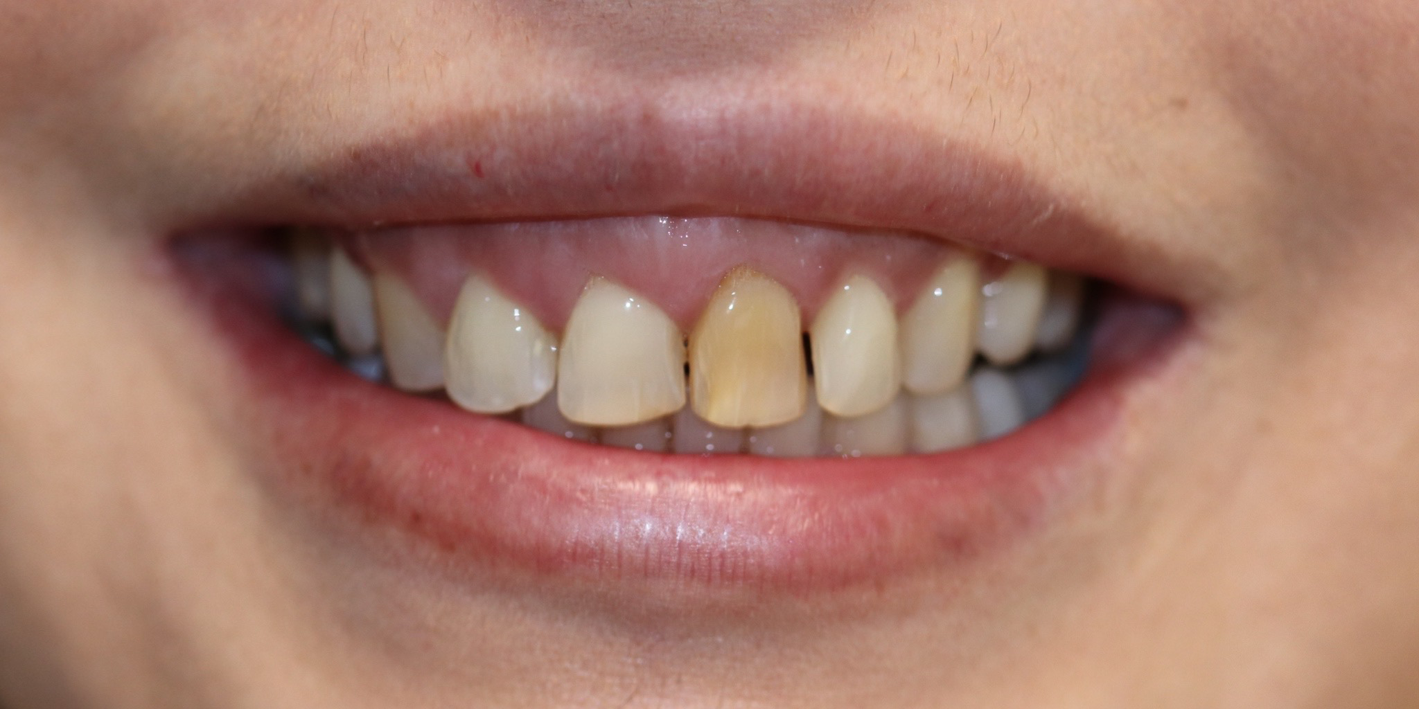 Zdjęcie przed metamorfozą