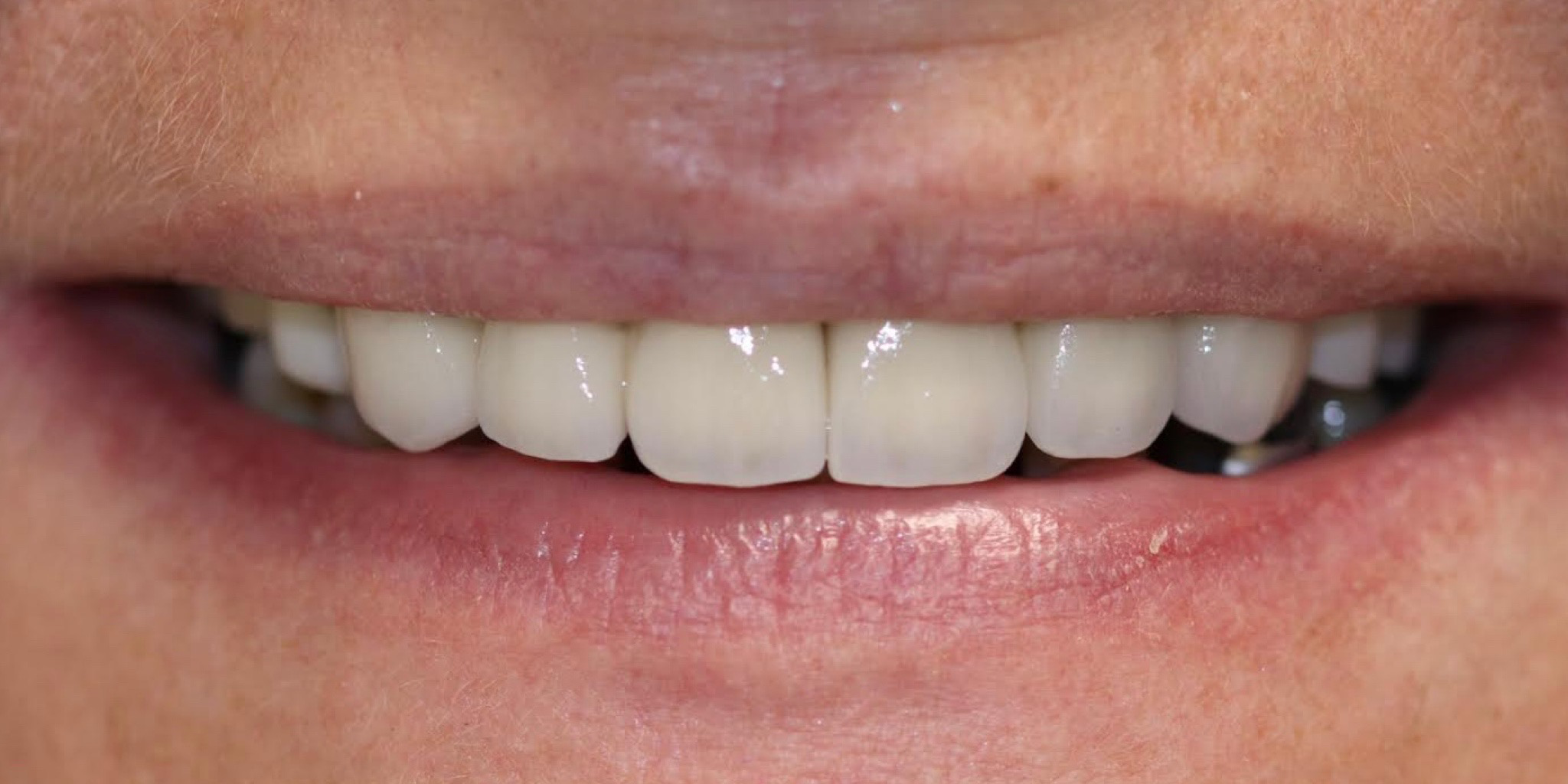 Zdjęcie po metamorfozie