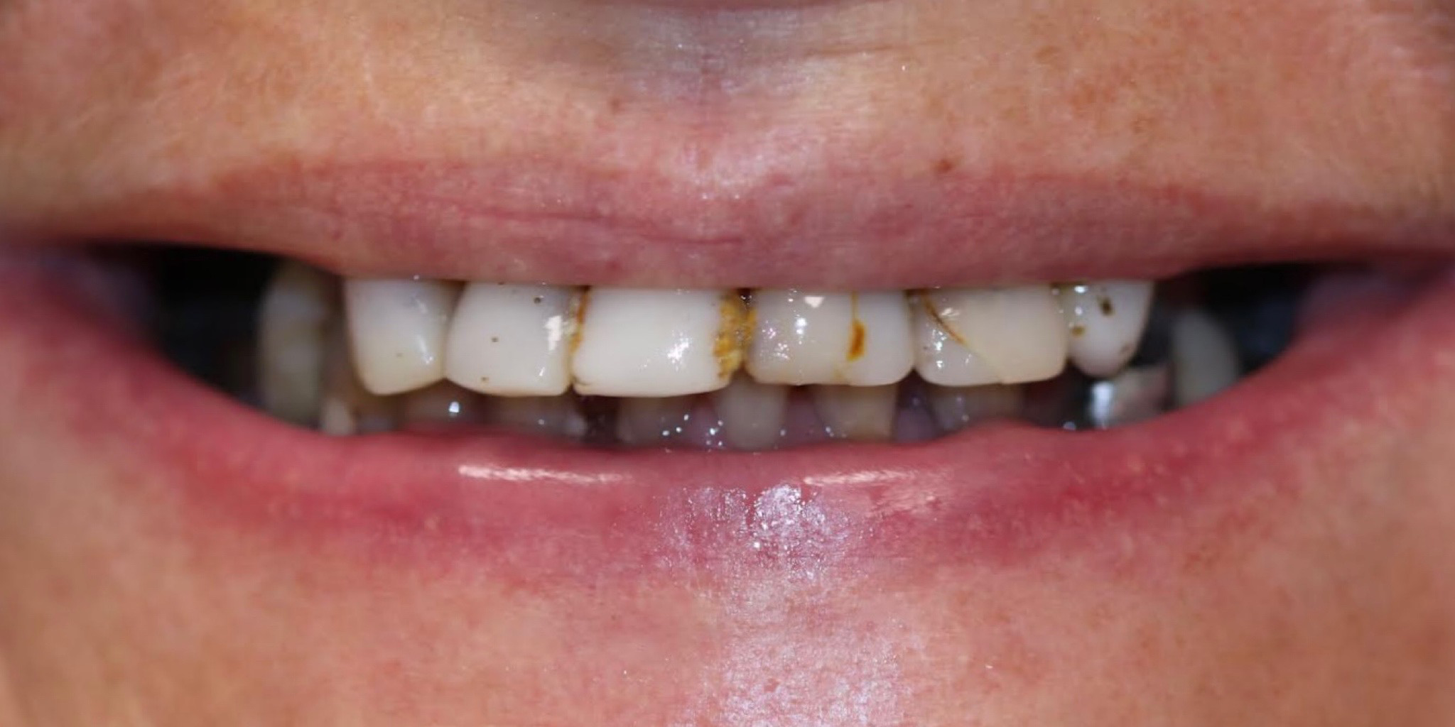 Zdjęcie przed metamorfozą