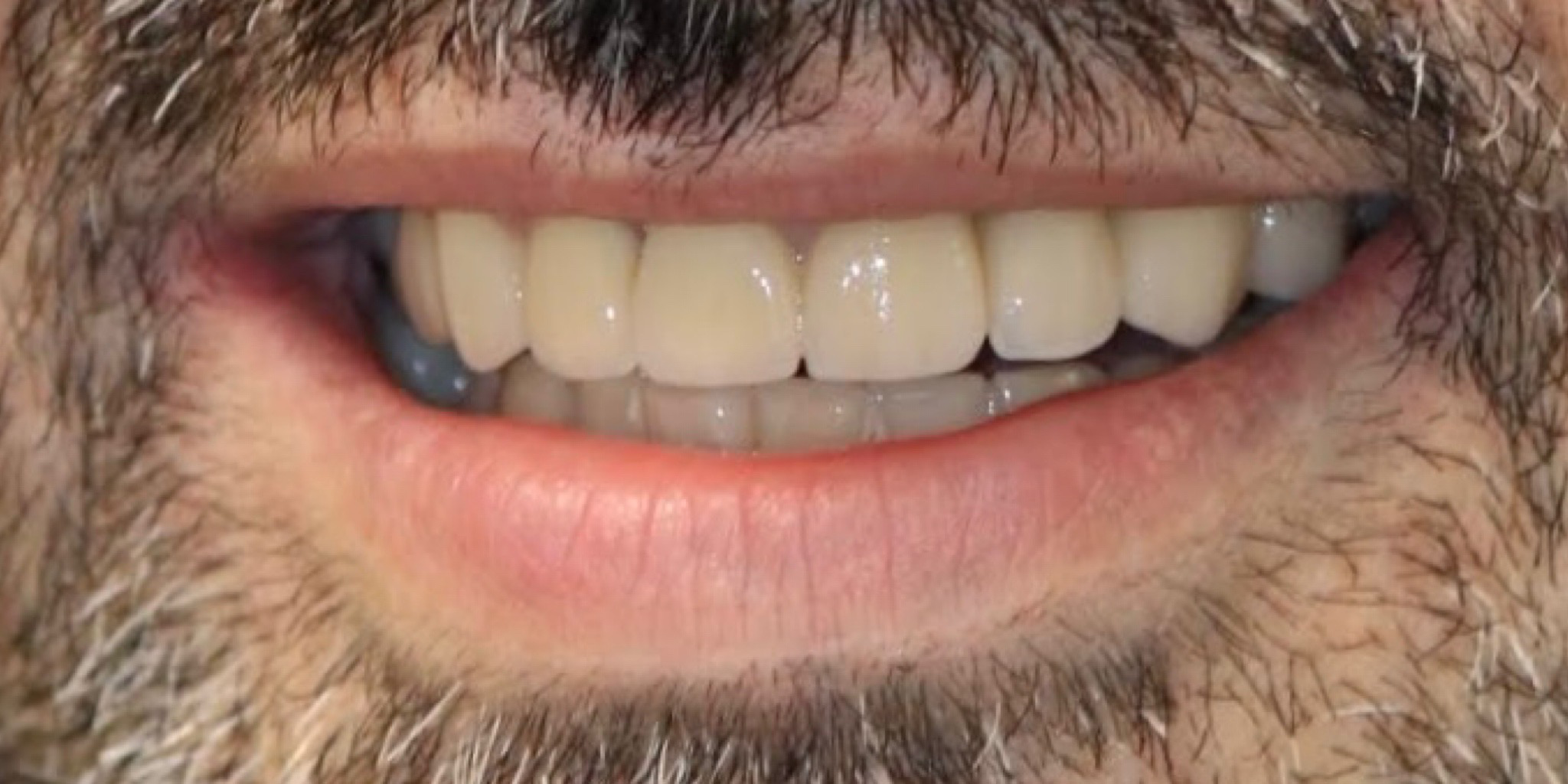 Zdjęcie po metamorfozie