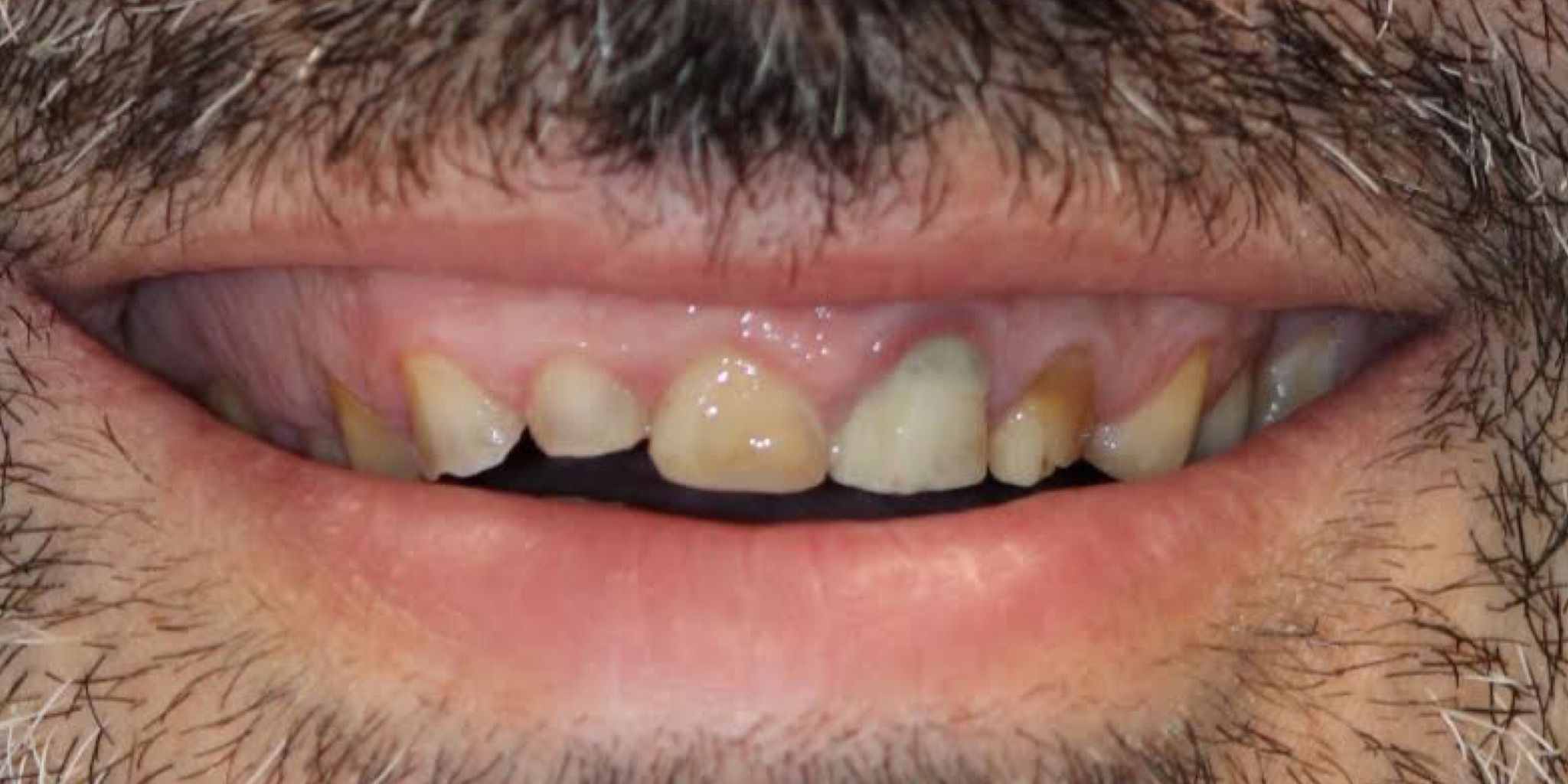 Zdjęcie przed metamorfozą