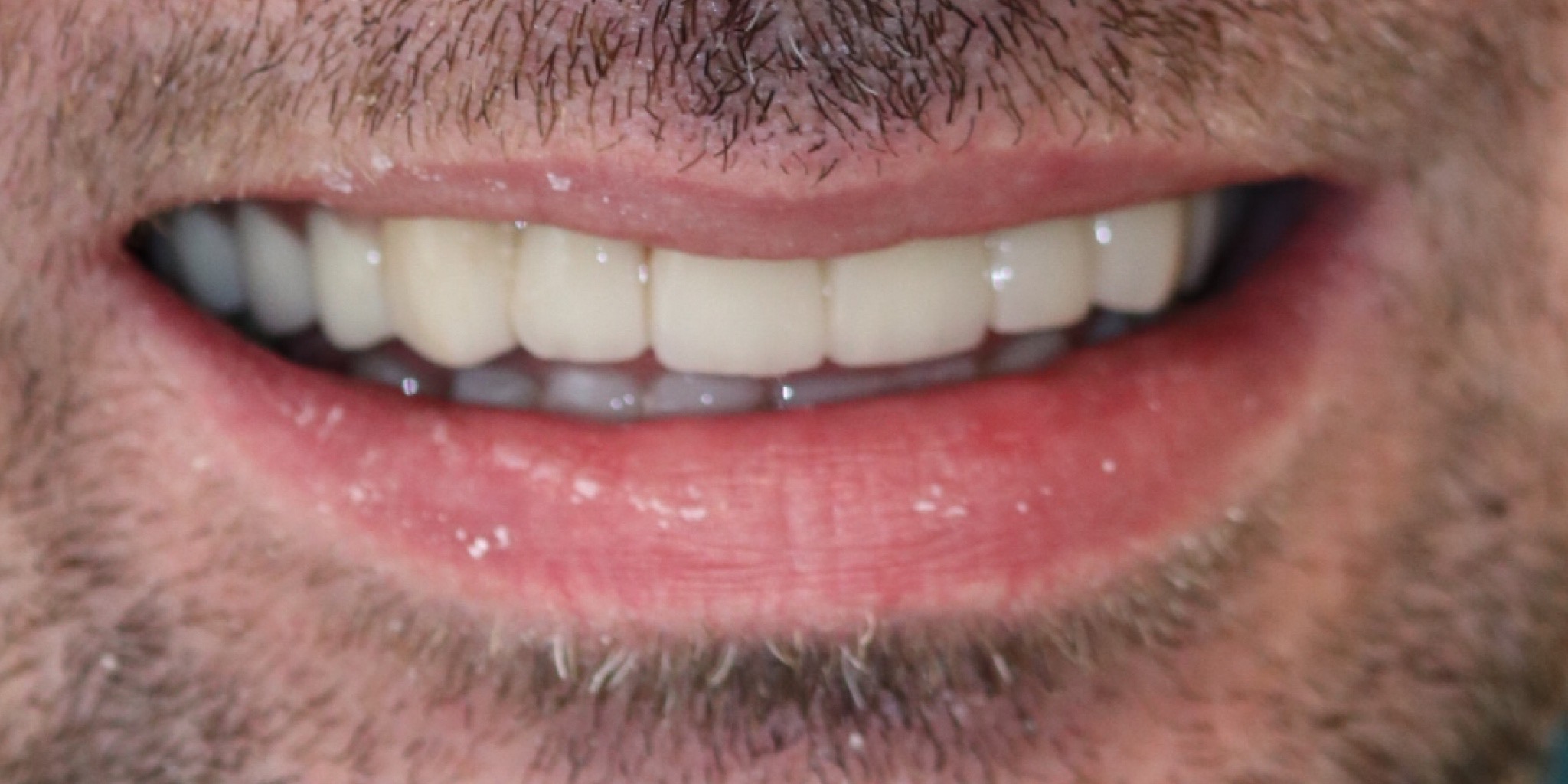 Zdjęcie po metamorfozie