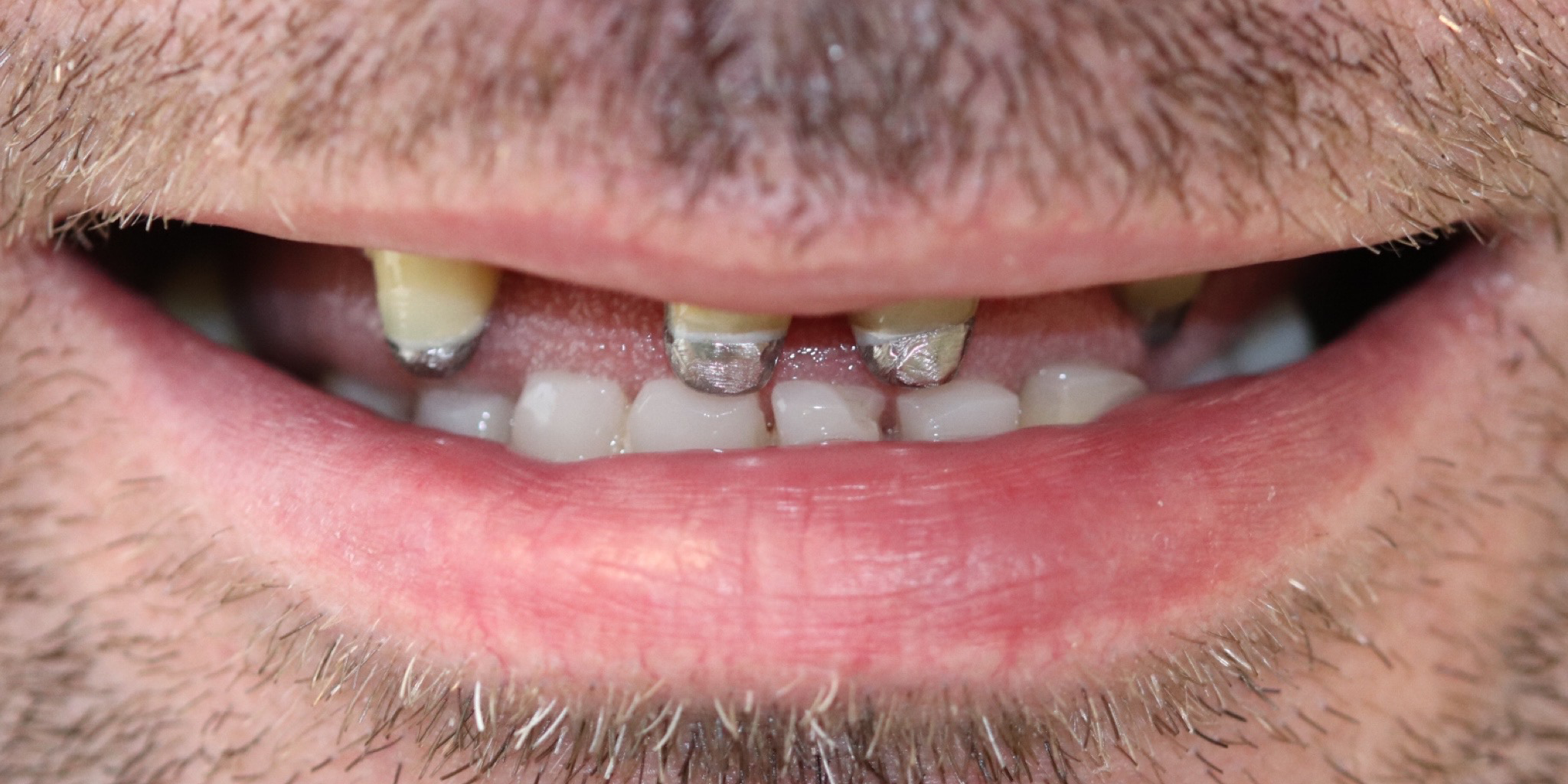 Zdjęcie przed metamorfozą