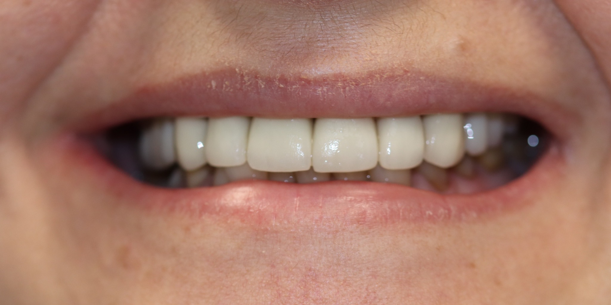 Zdjęcie po metamorfozie