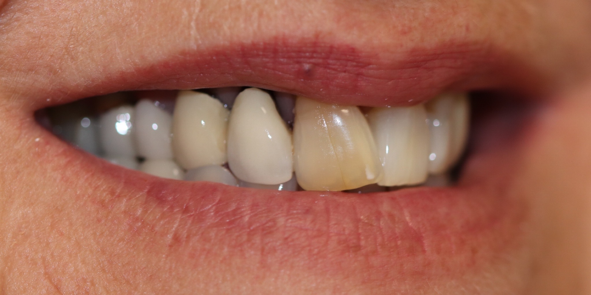 Zdjęcie przed metamorfozą