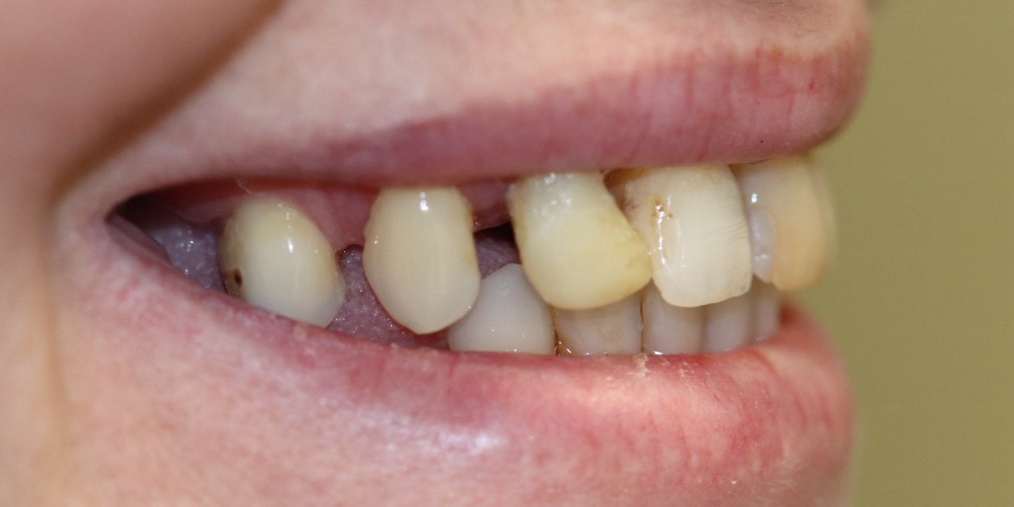 Zdjęcie przed metamorfozą