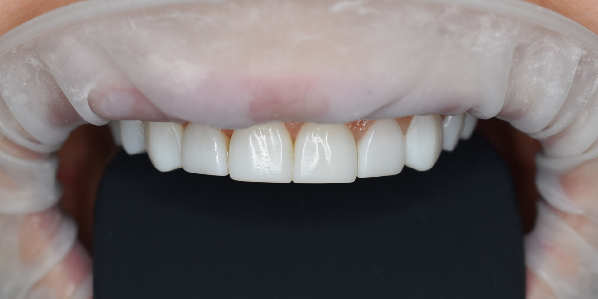 Zdjęcie po metamorfozie