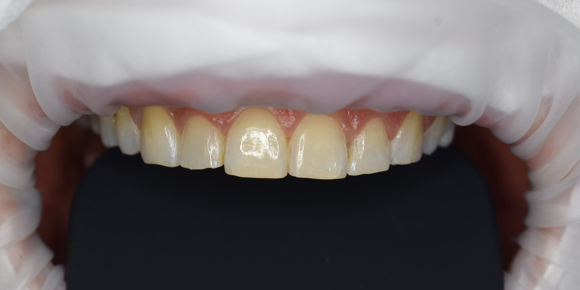 Zdjęcie przed metamorfozą