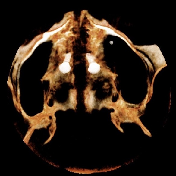 Rzut osiowy podniebienia